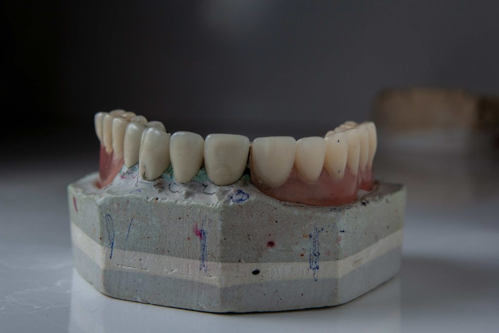 Dental Implants Dubai