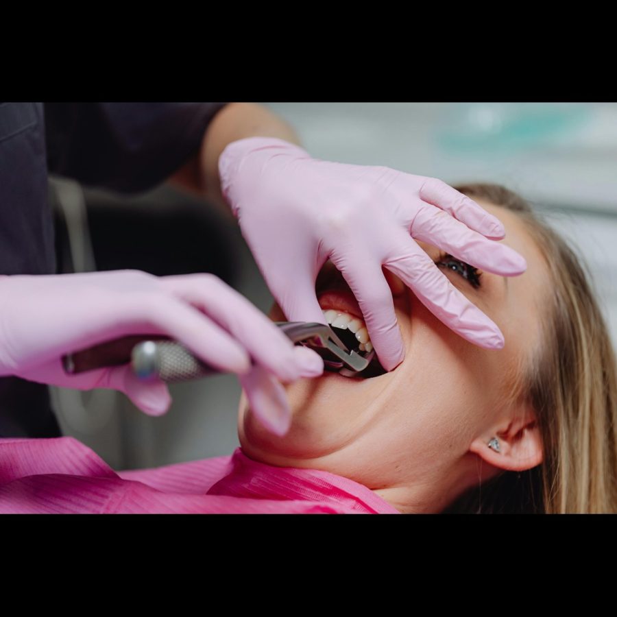 Wisdom Tooth Extraction Dubai