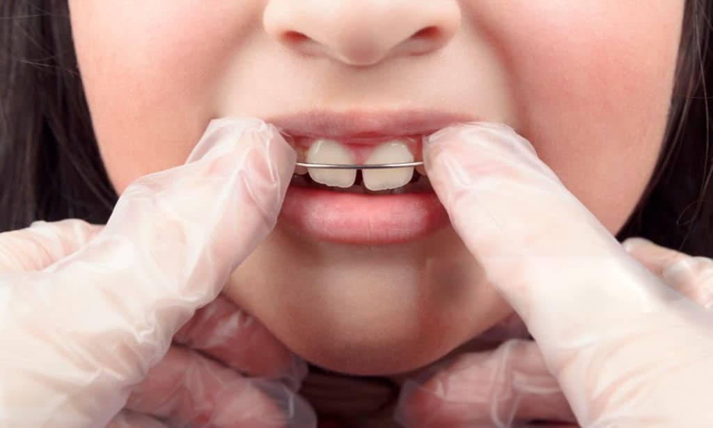 Emergency dental care at MMDC Dubai