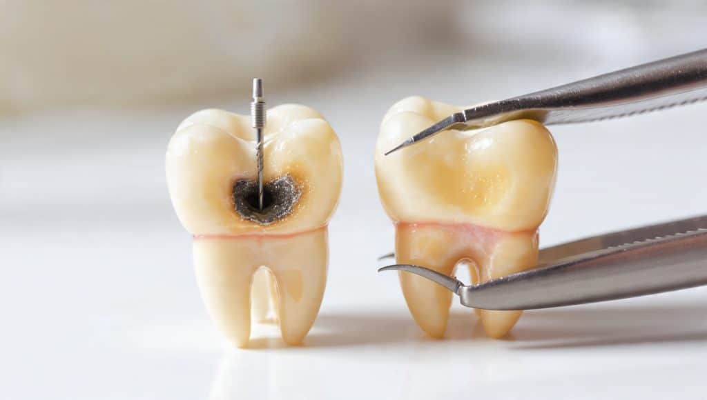 Dental veneer consultation at MMDC Dubai